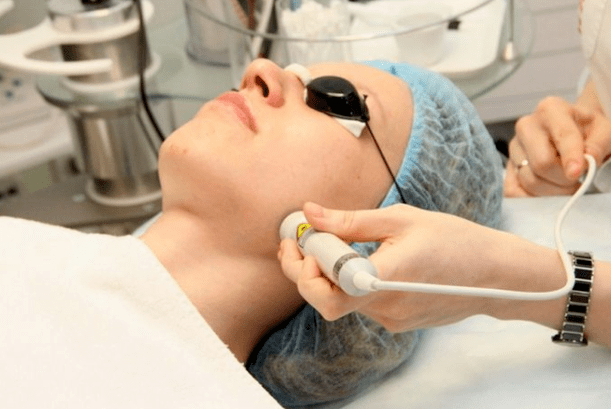 Laserová biorevitalizace